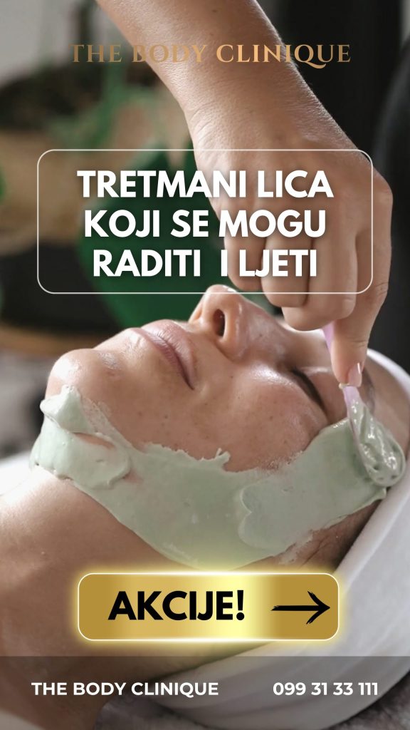 akcija 2