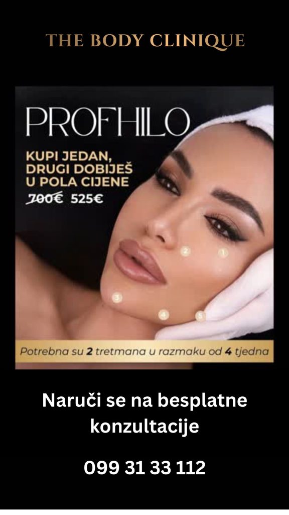 popusti