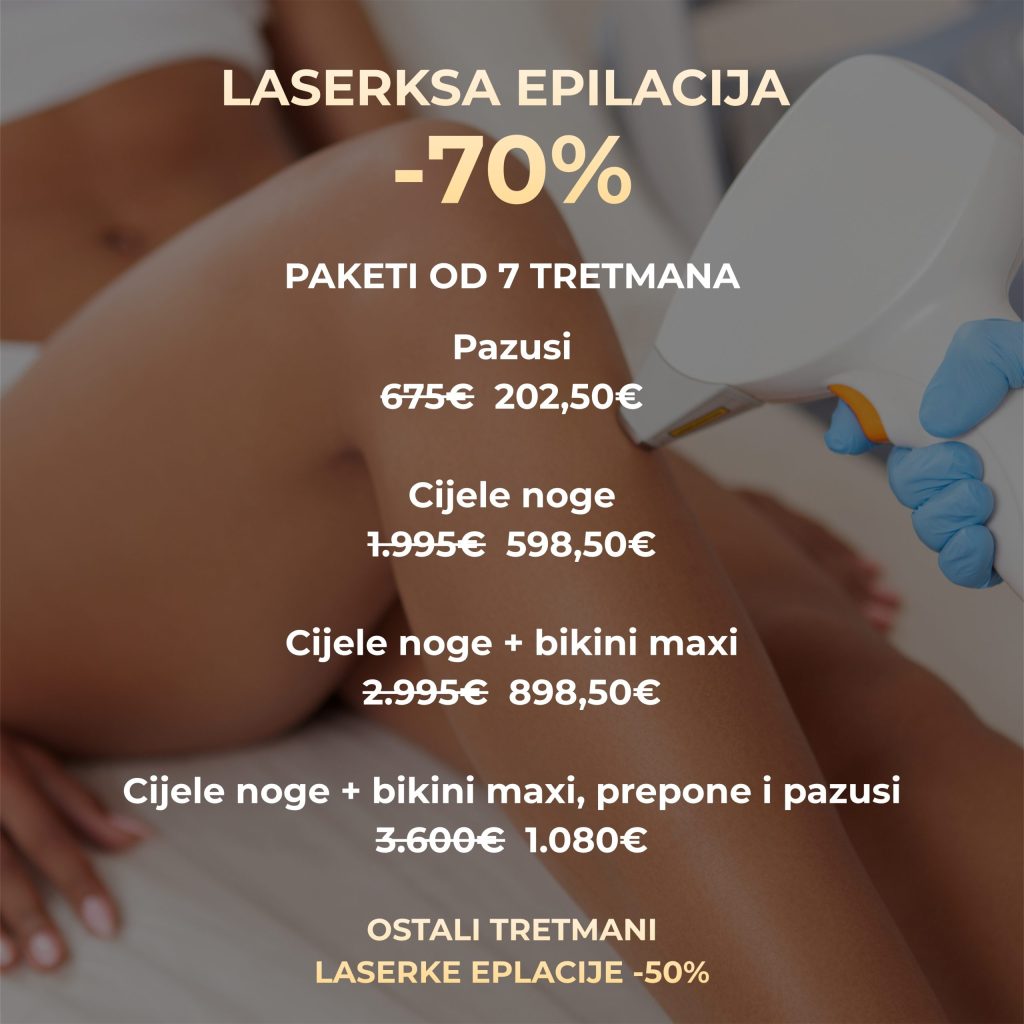 akcija
