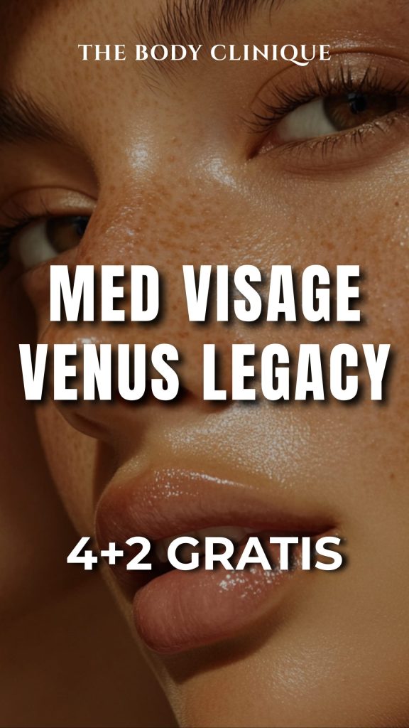 akcija4