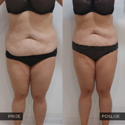 med contour