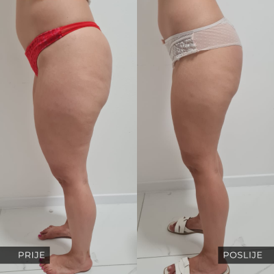 med contour