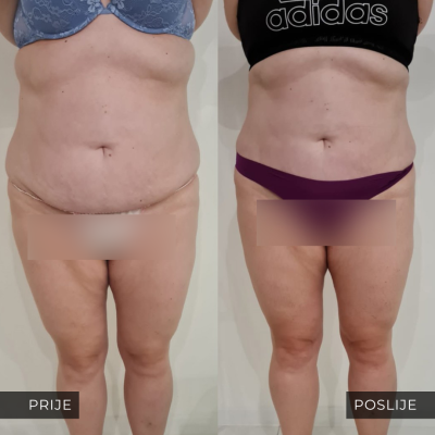 med contour