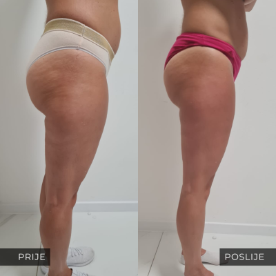 med contour