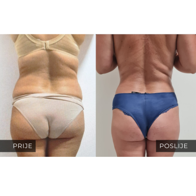 med contour