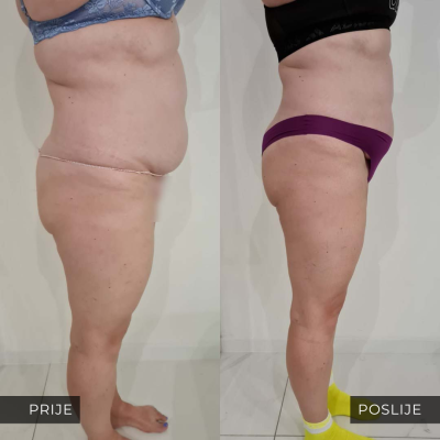 med contour
