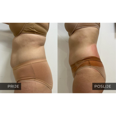med contour
