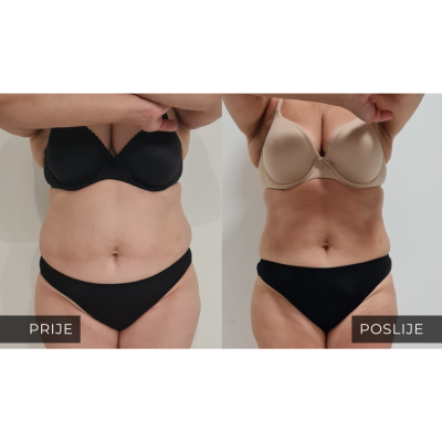 med contour